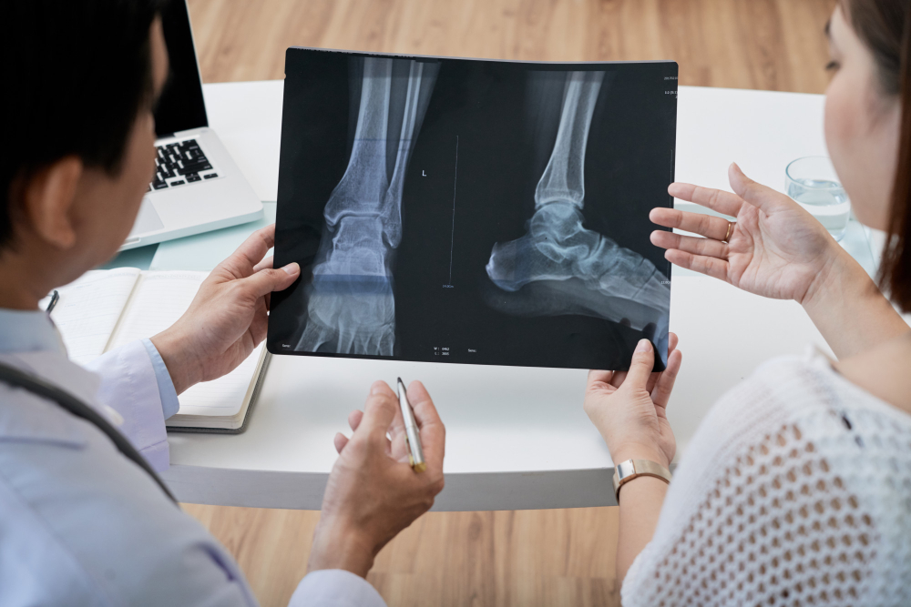 Understanding X-Rays for Ankle Sprains