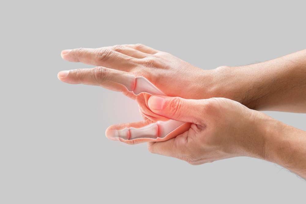 Understanding Thumb Arthritis