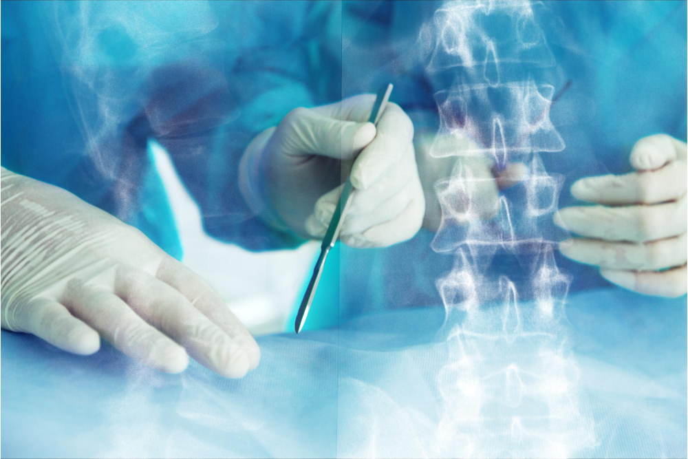 Exploring Minimally Invasive Spine Surgery