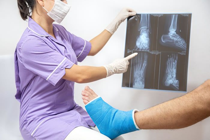 Diagnosing an ankle fracture